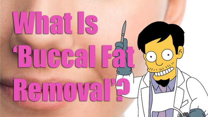 What is buccal fat removal