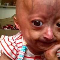 Adalia Rose