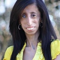 Lizzie Velasquez