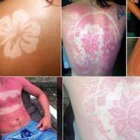 #SunburnArt