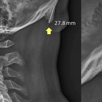 "Texting Horns" Theory