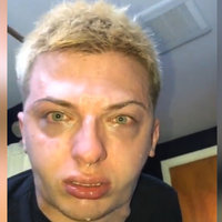 blonde guy with a runny nose looking feral