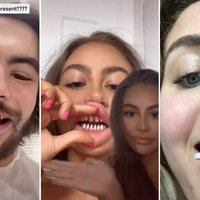 TikTok Teeth Shaving social media trend and veneers check challenge