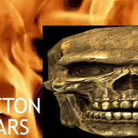 The Skeleton Appears meme template and format depicting a skull and flames.