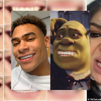 A before-after shot of tooth crowns/ cosmetic dental surgery. A photo of Love Island star Jordan Hames next to a photo of Shrek with large teeth photoshopped on.
