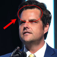 Matt Gaetz Rapey McForehead meme.
