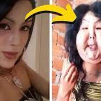 Juju do Pix facial surgery before and after.