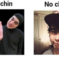 No Chin / Weak Chin