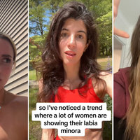 Labia Minora Trend