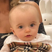 Paris Hilton's Son's Big Head