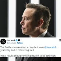 Neuralink Brain Chip Implant depicting elon musk and a tweet from him about the device.