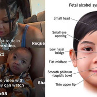 Blueface Chrisean Rock Baby Fetal Alcohol Syndrome theory posts.