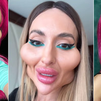 three photos of Anastasia Pokreshchuk, the woman with the world's largest cheeks
