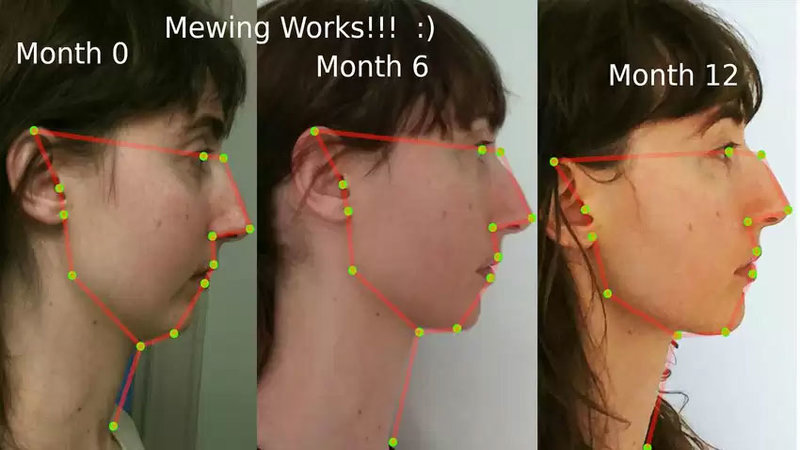 Mewing Know Your Meme