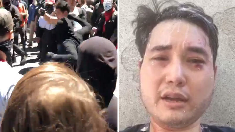 Antifa Assault of Andy Ngo