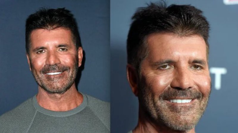 Simon Cowell's Face