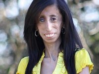 Lizzie Velasquez