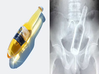 New Beach Corona Bottle image and meme examples.