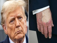 Donald Trump's Hand Makeup image examples.