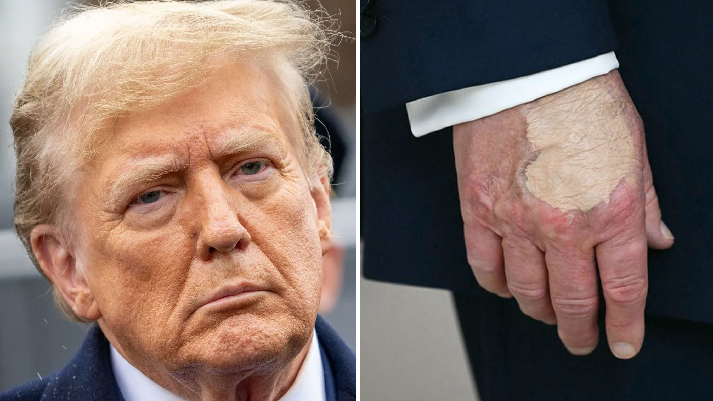 Donald Trump's Hand Makeup image examples.