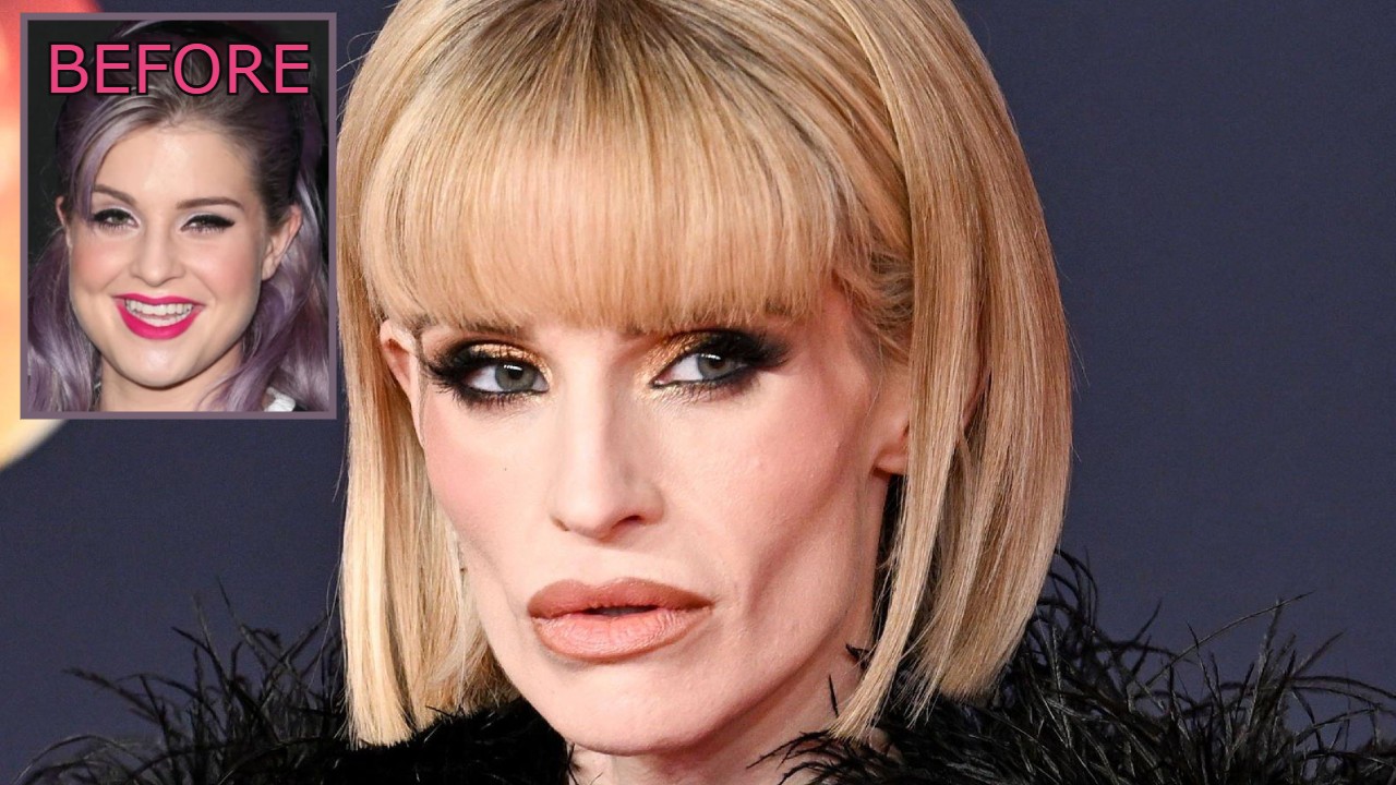 The Internet Won't Stop Speculating About Kelly Osbourne's Face