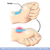 infographic of hands showing how to break a tendon 