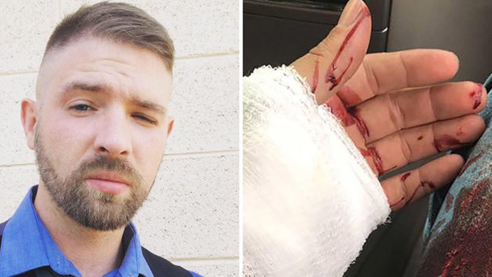 Joshua Witt, Neo-Nazi staring into the camera on the right, and his bloodied, bandaged hand on the left. 