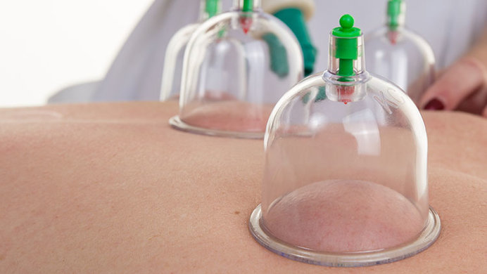 An image of cupping, one of the ways people are trying to undo their vaccinations.