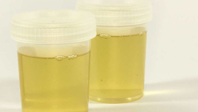 urine in a cup