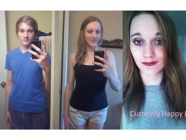 Estrogen transvestite male side affects