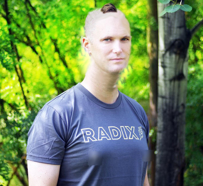 Richard Spencer Big Head (Meme) Richard Spencer Big Forehead Know