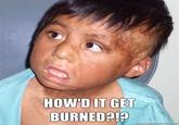 HOW'D IT GET BURNED?!P