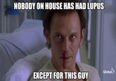 NOBODY ON HOUSE HAS HAD LUPUS EXCEPT FOR THIS GUYdloba