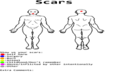 Scars '니 Show us your scars: Self Harm :Surgery :Burn :Animal :Childhood/Don't remember :Abuse/inflicted by other intentionally : other Extra Comments: