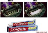 Before After givitisPlaque Colgate ota Whitening and Antigingivitis Toothpaste Anticavity Fluoride Helps Prevent Cavities-I GindivitiS·Plaque Colgate Gel and Antigingivitis Toothpaste Whitening Anticavity Fluoride NET W6.0 00 Fights Tartar Builduplo Whitens Teeth CEDRICEENT