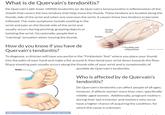 What is de Quervain's tendonitis? De Quervain's (dih-kwer-VAINS) tendonitis (or de Quervain's tenosynovitis) is inflammation of the sheath that covers the two tendons that help move the thumb. These tendons are located along the thumb-side of the wrist and when one overuses the wrist, it causes these two tendons to become inflamed. The main symptoms include swelling in the wrist and pain on the thumb side of the wrist and usually occurs during pinching, grasping objects or twisting the wrist. Occasionally, people feel a "catching" sensation when moving the thumb Tendon sheath Tendon How do you know if you have de Quervain's tendonitis? To diagnose, a clinician will have you perform the "Finklestein Test" where you place your thumb into the palm of your hand and make a fist around it, then bend your wrist down towards the floor. Sharp shooting pain usually occurs along the thumb side of your wrist and is symptomatic of Swelling and inflammation possible de Quervain's tendonitis Tendon Who is affected by de Quervain's tendonitis? De Quervain's tendonitis can affect people of all ages; however, it affects women more than men, specifically middle-aged women. Additionally, pregnant mothers during their last trimester and mothers who nurse have a higher chance of acquiring the condition, for which the cause is unknown Mayo Foundation for Medical Education Bnd Research. All rights reserved.