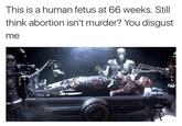 This is a human fetus at 66 weeks. Still think abortion isn't murder? You disgust me