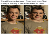 The difference between Chad and non-Chad (Incel) is literally a few millimeters of bone