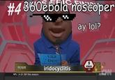 4 36085히anoscope r ay lol? 132 DEV toun iridocyclitis