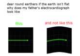 dear round earthers if the earth isn't flat why does my father's electrocardiograph look like this and not like this