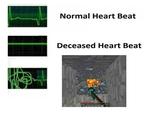 Normal Heart Beat Deceased Heart Beat