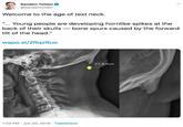 Sanden Totten @sandentotten Welcome to the age of text neck "... Young people are developing hornlike spikes at the back of their skulls bone spurs caused by the forward tilt of the head." wapo.st/2RqzRuo 27.8 mm 1:33 PM Jun 20, 2019 Tweet Deck