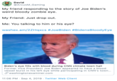 David @ArcusM_Gaming My friend responding to the story of Joe Biden's weird bloody zombie eye My Friend: Just drop out. Me: You talking to him or his eye? washex.am/2ZHqxcs #JoeBiden #BidensBloodyEye Biden's eye fills with blood during CNN climate town hall Former Vice President Joe Biden appeared to have a blood vessel burst in his left eye while participating in CNN's town... washingtonexaminer.com 11:06 PM Sep 4, 2019 Twitter Web Client