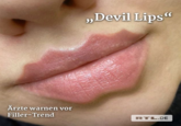 „Devil Lips“ Ärzte warnen vor Filler-Trend RTL.DE
