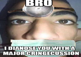 BRO I DIANOSE YOU WITH A MAJOR CRINGECUSSION