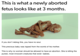 This is what a newly aborted fetus looks like at 3 months. If you don't reblog this, you have no soul. This precious baby was ripped from the womb of his mother. This is why no woman should be allowed to have an abortion. She is killing the purest, most innocent creatures that exist- babies.