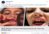 UNILAD .. UNLAD 15h O Once your teeth are shaved down, it can't be undone, and will likely result in a lifetime of expensive treatments. i UNILAD.CO.UK Teeth Shaving Tik Tokers Will Need Dentures By Their 40s, Dentists Say 8,5 K 4 K comentarii 1K distribuiri
