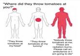 "Where did they throw tomatoes at you?" "Nobody threw tomatoes at me. These are "They threw "They threw tomatoes at my tummy" tomatoes at my head" radiation burns. Please call an ambulance or I am going to die"