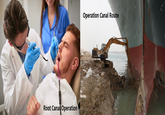 Operation Canal Route Root Canal Operation