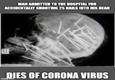MAN ADMITTED TO THE HOSPITAL FOR ACCIDENTALLY SHOOTING 25 NAILS INTO HIS HEAD DIES OF CORONA VIRUS imgfilip.com